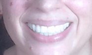my teeth